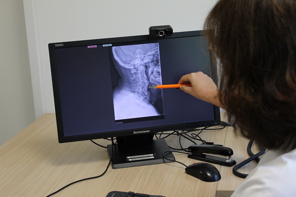 La Dra. Claveguera mostrant una columna ossificada. 